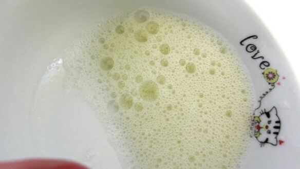 ШАГ 6. котлеты сочные