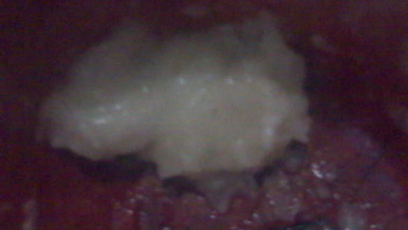 ШАГ 4. маринованная свекла по-грузински